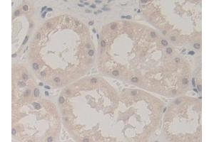 Detection of UBA52 in Human Kidney Tissue using Polyclonal Antibody to Ubiquitin A 52 Residue Ribosomal Protein Fusion Product 1 (UBA52)