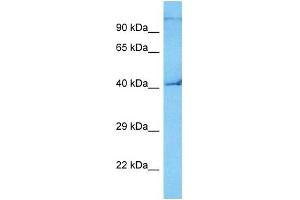 Host:  Mouse  Target Name:  E2F3  Sample Tissue:  Mouse Small Intestine  Antibody Dilution:  1ug/ml (E2F3 抗体  (C-Term))