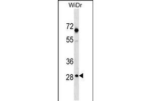 Western blot analysis in WiDr cell line lysates (35ug/lane). (SNX11 抗体  (AA 75-104))