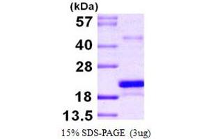 SDS-PAGE (SDS) image for Methionine Sulfoxide Reductase B3 (MSRB3) (AA 21-185) protein (His tag) (ABIN667884)