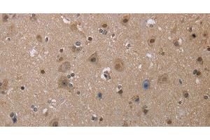 Immunohistochemistry of paraffin-embedded Human brain tissue using MGLL Polyclonal Antibody at dilution 1:40 (MGLL 抗体)