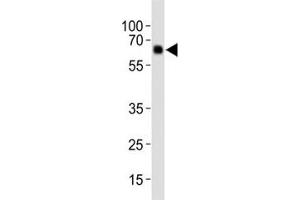 Western blot analysis of lysate from human placenta tissue, using Park6/ PINK1 antibody diluted at 1:1000. (PINK1 抗体  (AA 118-147))
