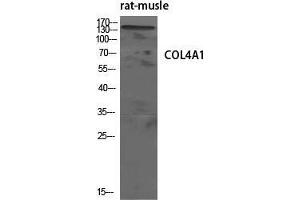 Western Blot (WB) analysis of specific cells using COL4A1 Polyclonal Antibody.