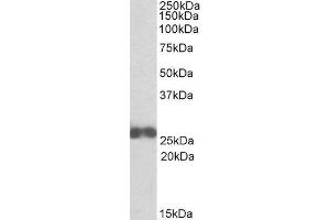ABIN2561201 (0. (ARHGDIB 抗体  (N-Term))