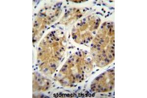 MGC24975 Antibody (C-term) immunohistochemistry analysis in formalin fixed and paraffin embedded human stomach tissue followed by peroxidase conjugation of the secondary antibody and DAB staining. (PRR22 抗体  (C-Term))