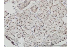 Immunostaining (ISt) image for anti-Slingshot Homolog 3 (SSH3) (AA 293-391) antibody (ABIN565792)
