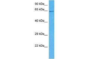 Host:  Mouse  Target Name:  SMAD4  Sample Tissue:  Mouse Kidney  Antibody Dilution:  1ug/ml (SMAD4 抗体  (N-Term))