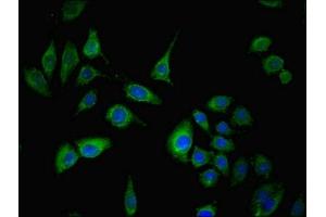 Immunofluorescent analysis of A549 cells using ABIN7170610 at dilution of 1:100 and Alexa Fluor 488-congugated AffiniPure Goat Anti-Rabbit IgG(H+L) (SPIN4 抗体  (AA 1-249))