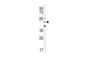 CRFR2D Antibody (ABIN655259 and ABIN2837856) western blot analysis in Hela cell line lysates (35 μg/lane). (CRFR2D 抗体)