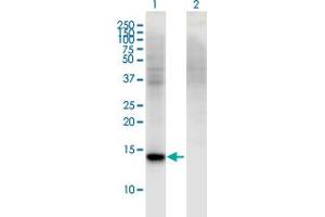 Western Blot analysis of RBP7 expression in transfected 293T cell line by RBP7 monoclonal antibody (M01), clone 4F4. (RBP7 抗体  (AA 35-134))