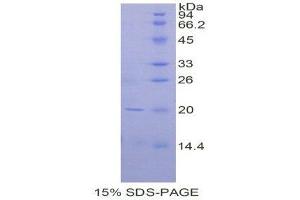 SDS-PAGE (SDS) image for CD247 Molecule (CD247) (AA 1-160) protein (His tag) (ABIN1878053) (CD247 Protein (AA 1-160) (His tag))