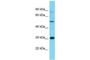 Western Blotting (WB) image for anti-Olfactory Receptor, Family 7, Subfamily E, Member 86 Pseudogene (OR7E86P) (C-Term) antibody (ABIN2791455)