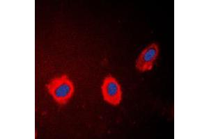 Immunofluorescent analysis of Cytokeratin 17 staining in HeLa cells.