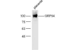 Mouse placenta lysates probed with Rabbit Anti-GRP94 Polyclonal Antibody, Unconjugated  at 1:500 for 90 min at 37˚C