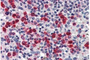 Human Spleen (formalin-fixed, paraffin-embedded) stained with LCN2 antibody ABIN337222 at 2. (Lipocalin 2 抗体  (AA 60-72))