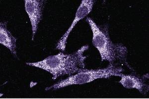Immunofluorescent staining of NIH-3T3 cells. (LIM Domain Kinase 1 抗体  (AA 232-333))