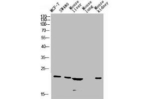 Western blot analysis of Jurkat U937 Raji mouse-eye lysate, antibody was diluted at 1000. (CGRP 抗体  (AA 80-141))