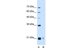 Western Blotting (WB) image for anti-Placenta-Specific 1-Like (PLAC1L) antibody (ABIN2463114) (PLAC1L 抗体)