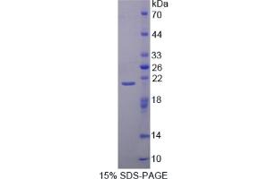 SDS-PAGE of Protein Standard from the Kit  (Highly purified E. (CAPN1 ELISA 试剂盒)