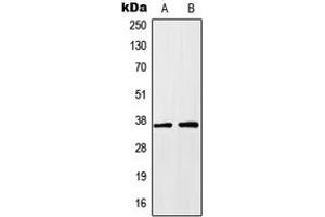 Western blot analysis of HOXA1 expression in HEK293T (A), HeLa (B) whole cell lysates. (HOXA1 抗体  (Center))