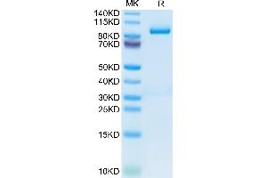 Periostin Protein (POSTN) (AA 24-811) (His tag)