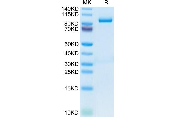 Periostin Protein (POSTN) (AA 24-811) (His tag)