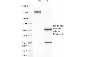 SDS-PAGE Analysis Purified CD80 Mouse Monoclonal Antibody (C80/2723). (CD80 抗体  (AA 35-142))