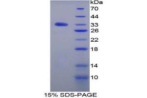 SDS-PAGE analysis of Rat TGFbR3 Protein. (TGFBR3 蛋白)