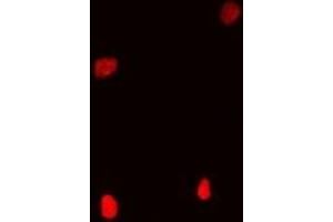 Immunofluorescent analysis of Coilin staining in Hela cells. (Coilin 抗体)