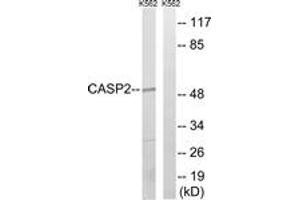 Western blot analysis of extracts from K562, using Caspase 2 (Ab-157) Antibody. (Caspase 2 抗体  (AA 123-172))
