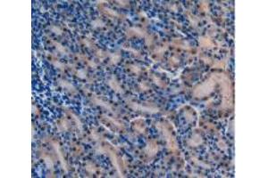 IHC-P analysis of Mouse Kidney Tissue, with DAB staining. (Laminin alpha 1 抗体  (AA 2640-2773))