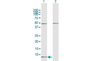 Western Blot analysis of CCL15 expression in transfected 293T cell line by CCL15 MaxPab polyclonal antibody. (CCL15 抗体  (AA 1-113))