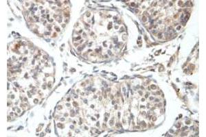 Immunohistochemical staining of formalin-fixed paraffin-embedded human fetal testis tissue showing nuclear staining with RBBP6 polyclonal antibody  at 1 : 100 dilution. (RBBP6 抗体  (N-Term))