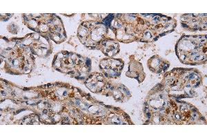 Immunohistochemistry of paraffin-embedded Human placenta using P3H3 Polyclonal Antibody at dilution of 1:50 (LEPREL2 抗体)