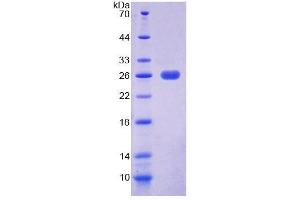 SDS-PAGE (SDS) image for Eukaryotic Translation Elongation Factor 2 (EEF2) (AA 32-233) protein (His tag) (ABIN6239097)