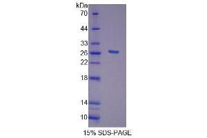 SDS-PAGE analysis of Human FGF20 Protein.