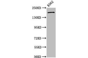 Western Blot Positive WB detected in: K562 whole cell lysate All lanes: PSME4 antibody at 4.