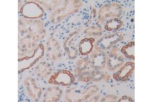 Immunohistochemistry (IHC) image for anti-tyrosine Kinase with Immunoglobulin-Like and EGF-Like Domains 1 (TIE1) (AA 835-1134) antibody (ABIN1871557)