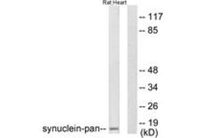 Western blot analysis of extracts from rat heart cells, using Synuclein-pan Antibody. (Synuclein 抗体  (AA 15-64))