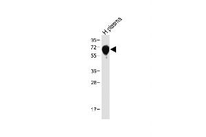 Western Blotting (WB) image for anti-serpin Peptidase Inhibitor, Clade A (Alpha-1 Antiproteinase, Antitrypsin), Member 6 (SERPINA6) (AA 197-225) antibody (ABIN654693)