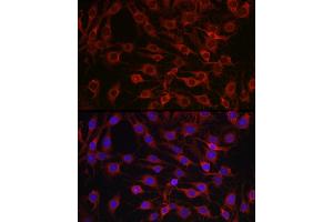 Immunofluorescence analysis of C6 cells using MARCKS Rabbit pAb (ABIN6134393, ABIN6143555, ABIN6143556 and ABIN6214033) at dilution of 1:100 (40x lens). (MARCKS 抗体  (AA 1-100))