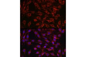 Immunofluorescence analysis of C6 cells using MARCKS Rabbit pAb (ABIN6134393, ABIN6143555, ABIN6143556 and ABIN6214033) at dilution of 1:100 (40x lens). (MARCKS 抗体  (AA 1-100))