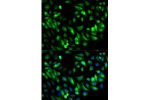 Immunofluorescence (IF) image for anti-Glycyl-tRNA Synthetase (GARS) antibody (ABIN1876623) (GARS 抗体)