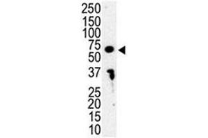 Western blot analysis of IRAK3 antibody and HL-60 cell lysate. (IRAK3 抗体  (AA 45-77))