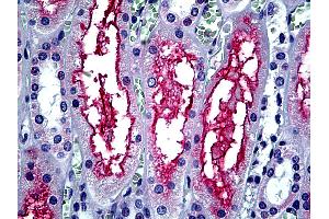 Anti-ACE-2 antibody IHC of human kidney. (ACE2 抗体  (Internal Region))