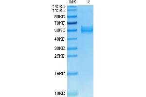 Mouse ICOS on Tris-Bis PAGE under reduced condition. (ICOS Protein (AA 21-144) (Fc Tag))