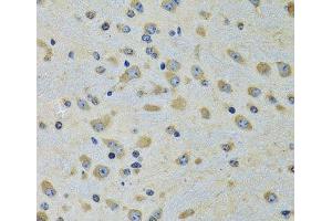 Immunohistochemistry of paraffin-embedded Rat brain using DARS Polyclonal Antibody at dilution of 1:100 (40x lens). (DARS 抗体)