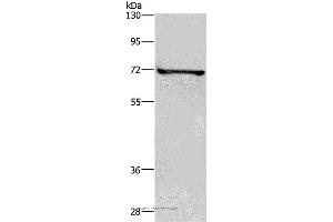 Western blot analysis of HT-29 cell, using TRIM29 Polyclonal Antibody at dilution of 1:400 (TRIM29 抗体)