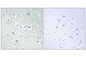 Immunohistochemistry analysis of paraffin-embedded human brain tissue using PLA1A antibody. (PLA1A 抗体  (C-Term))