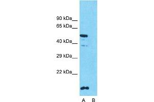 Western Blotting (WB) image for anti-Solute Carrier Family 10 (Sodium/bile Acid Cotransporter Family), Member 1 (SLC10A1) (Middle Region) antibody (ABIN2777141)